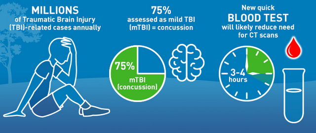New Blood Test Aids in Evaluating Concussion in Adults