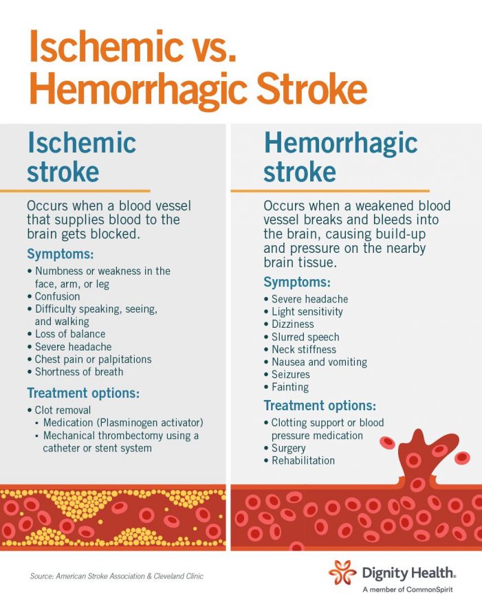 What Type of Stroke Is It?  ~ Health Update from Mark Twain Medical Center